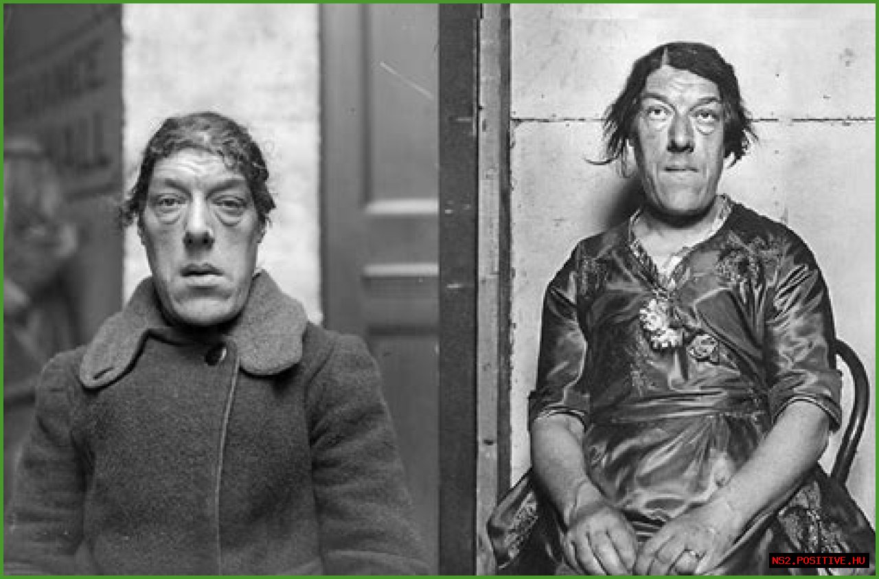 The Surprising Truth About Being Dubbed The Ugliest Person In The World